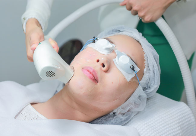 IPL photofacial procedure