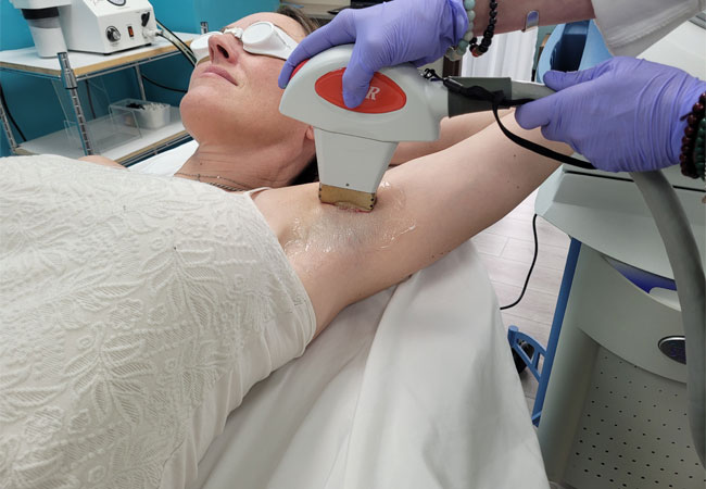 armpit hair removal procedure